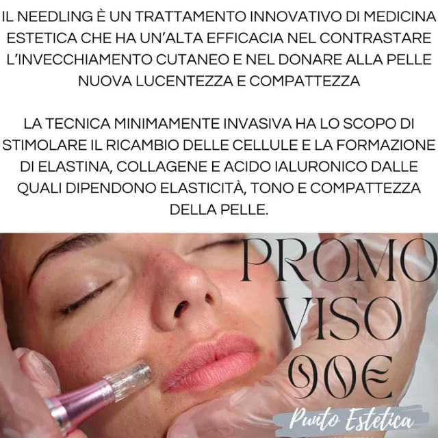 Trattamento needling